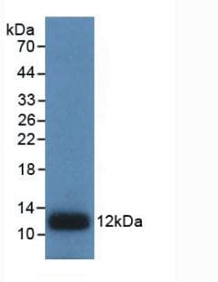 IL8 / Interleukin 8 Antibody (clone C4)