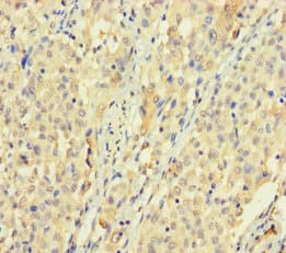 Polyclonal Rabbit anti-Human SPATS1 Antibody