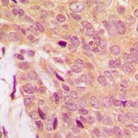 MNK / ATP7A Antibody (Internal)