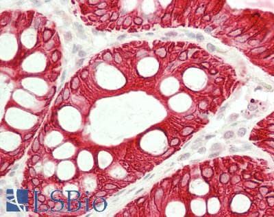 IHC-plus™ Polyclonal Rabbit anti-Human KRT19 / CK19 / Cytokeratin 19 Antibody (aa 204-332, IHC)