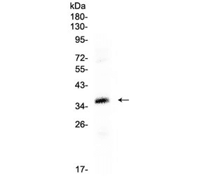 Polyclonal Rabbit anti-Human CRD / CRX Antibody (WB)