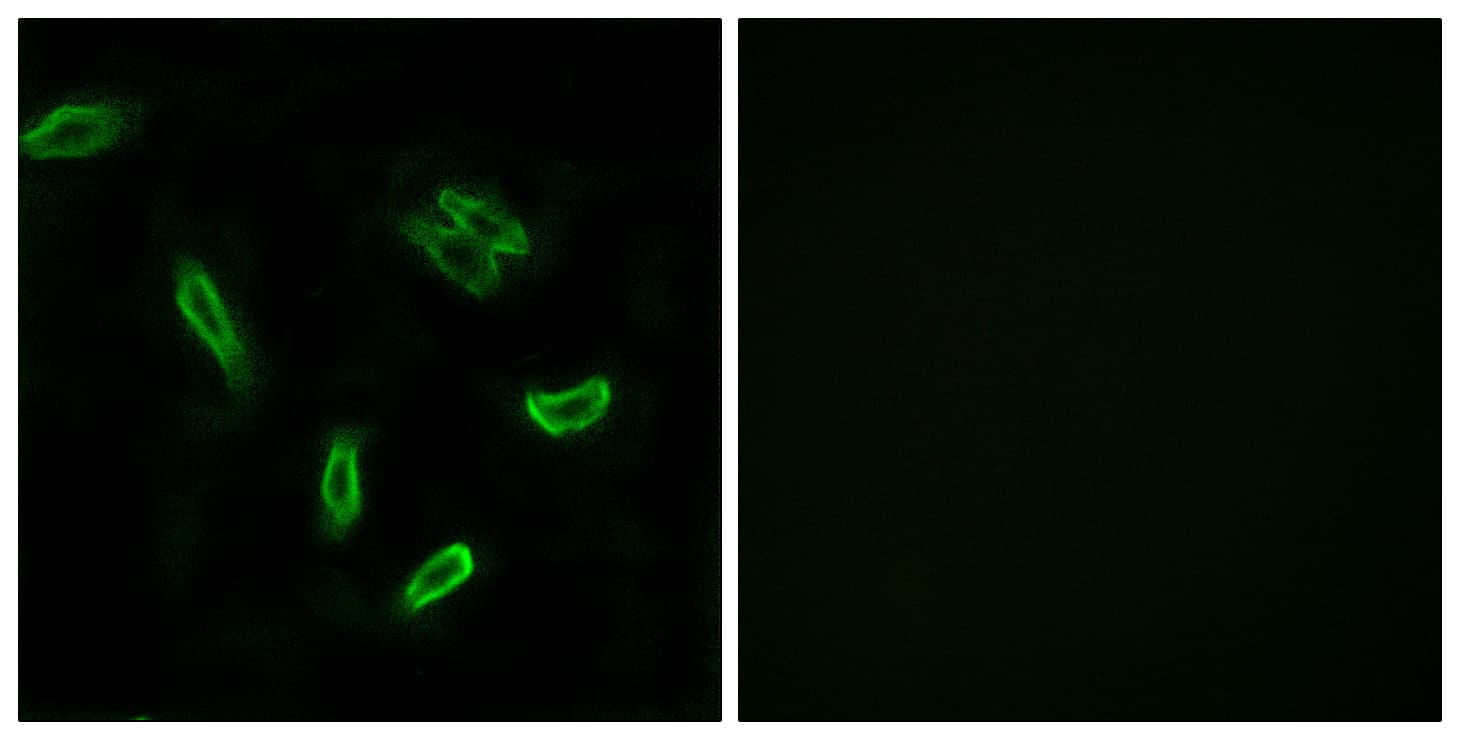 Polyclonal Rabbit anti-Human SLC27A5 / BACS Antibody (aa481-530, IHC, IF, WB)