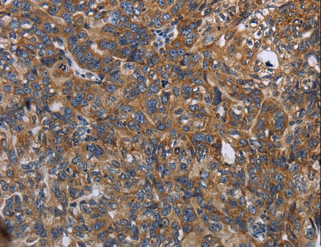 LGALS2 / Galectin 2 Antibody