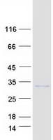 Human PQLC1 Protein (Recombinant Myc-DDK (Flag))