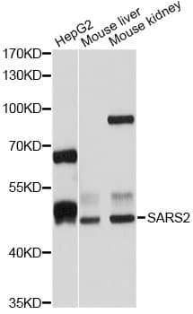 Polyclonal Rabbit anti-Human SARS2 / SYS Antibody (IHC, WB)