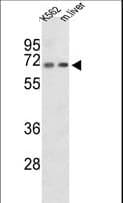 Polyclonal Rabbit anti-Human COT / CROT Antibody (aa49-79, IHC, WB)