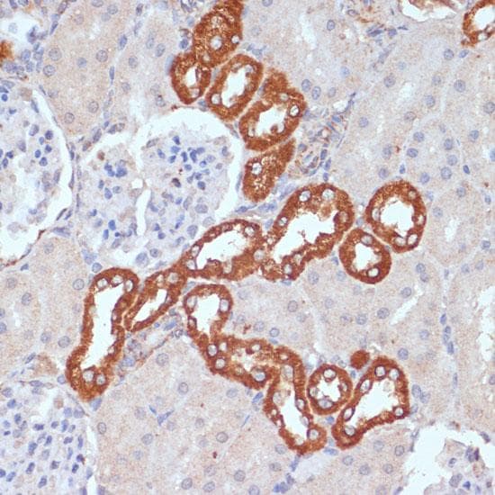 PDGFRB / PDGFR Beta Antibody