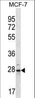 Polyclonal Rabbit anti-Human PSMB10 Antibody (aa214-242, WB)