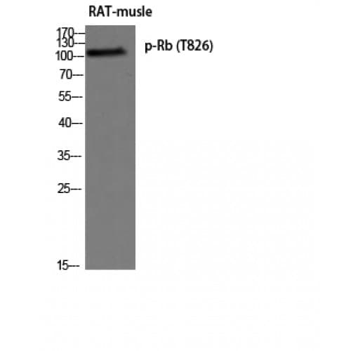 Polyclonal Rabbit anti-Human RB1 / Retinoblastoma / RB Antibody (570-650 aa, IHC, IF, WB)