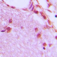 hnRNP H1+H2 Antibody (Internal)