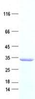 Human PDCL2 Protein (Recombinant His, N-Terminal)