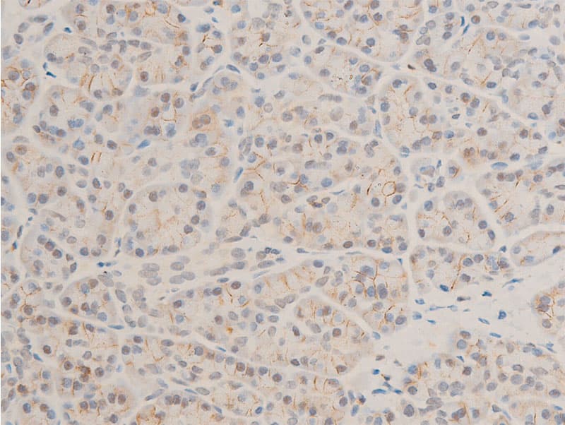 MAP3K7 / TAK1 Antibody (phospho-Thr187)