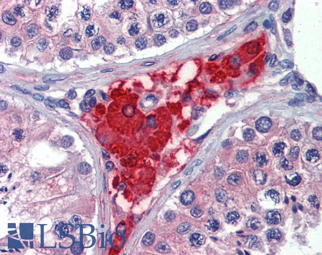 IHC-plus™ PRTFDC1 / HHGP Antibody