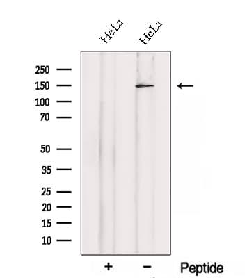 SETBP1 / SEB Antibody