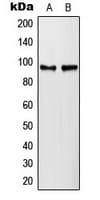 Polyclonal Rabbit anti-Human PLA2G4A Antibody (phospho-Ser505, IHC, IF, WB)