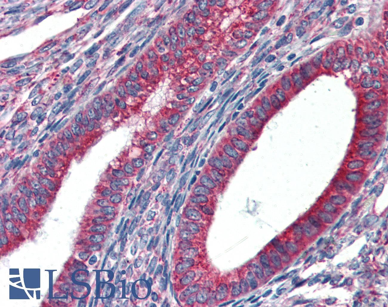 IHC-plus™ Polyclonal Goat anti-Human HSP90B1 / GP96 / GRP94 Antibody (aa593-606, IHC, WB)