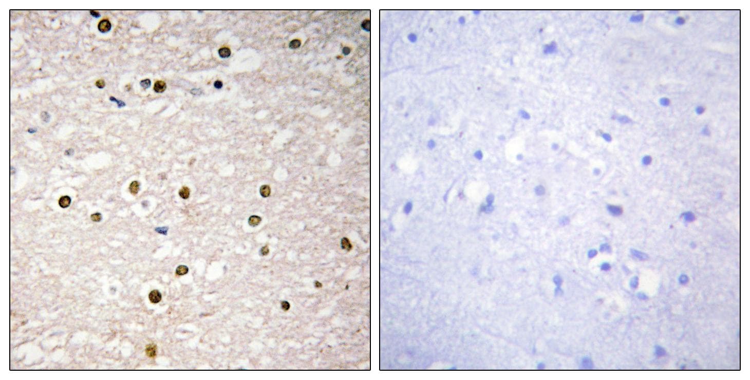 TP73 / p73 Antibody
