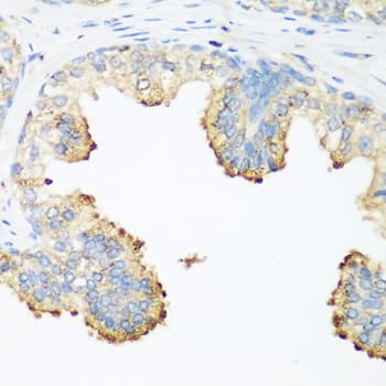 Polyclonal Rabbit anti-Human PLEK / Pleckstrin Antibody (IHC, WB)