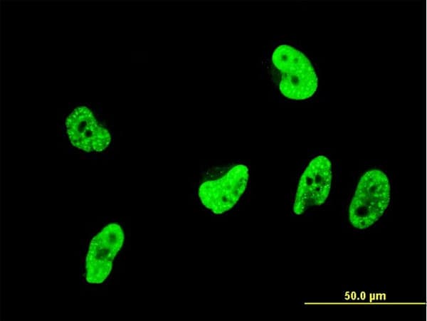 OXSR1 / OSR1 Antibody (clone 1D10)