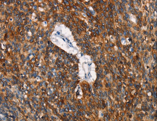 CD68 Antibody