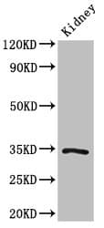 Polyclonal Rabbit anti-Human KLF7 Antibody (WB)