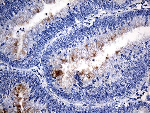 Monoclonal Mouse anti-Human TFF1 / pS2 Antibody (clone OTI1A4, aa25-84, IHC, WB)