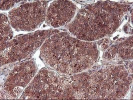 FGF21 Antibody (clone OTI2F10)