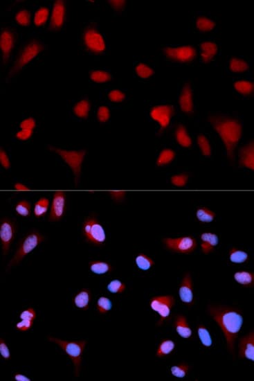 Polyclonal Rabbit anti-Human ABL1 / c-ABL Antibody (phospho-Tyr204, IF, WB)