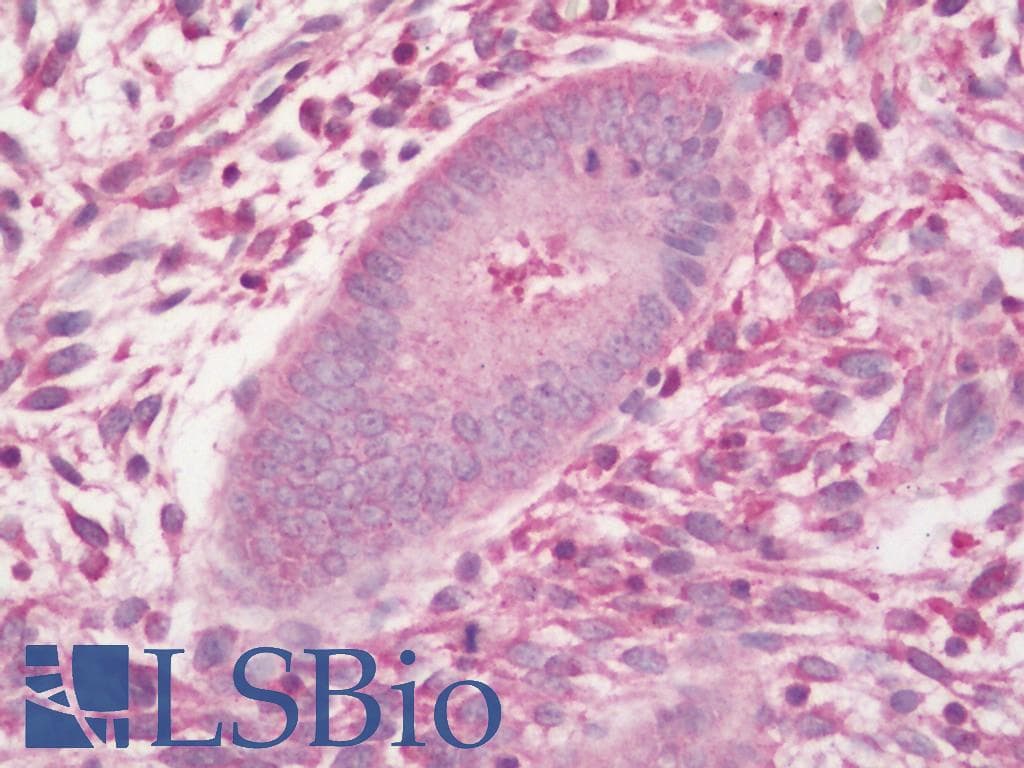 IHC-plus™ Polyclonal Rabbit anti-Human PLEKHA8 Antibody (aa122-400, IHC, WB)