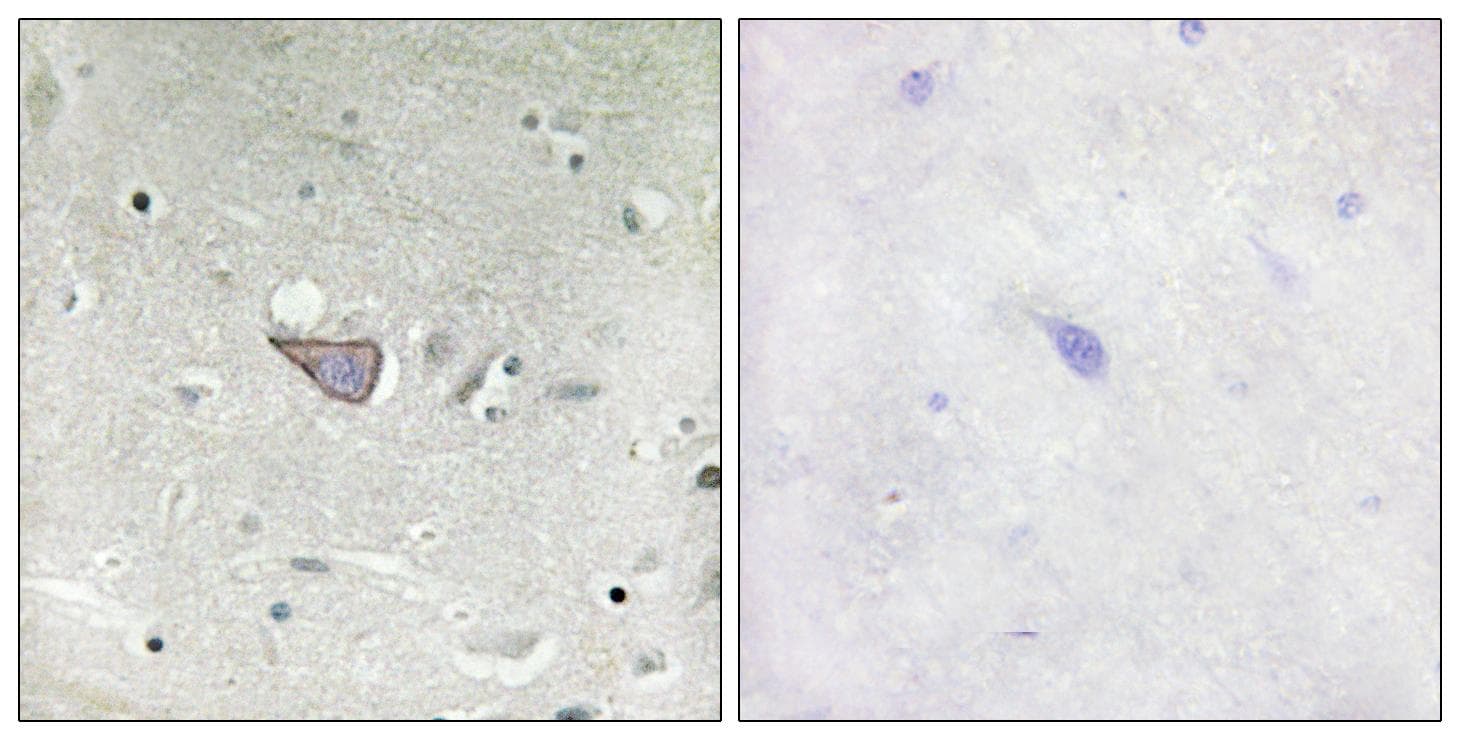 ARMCX3 Antibody