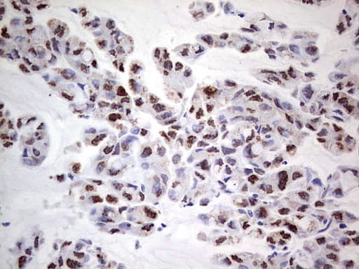 PCNA Antibody (clone OTI13G4)