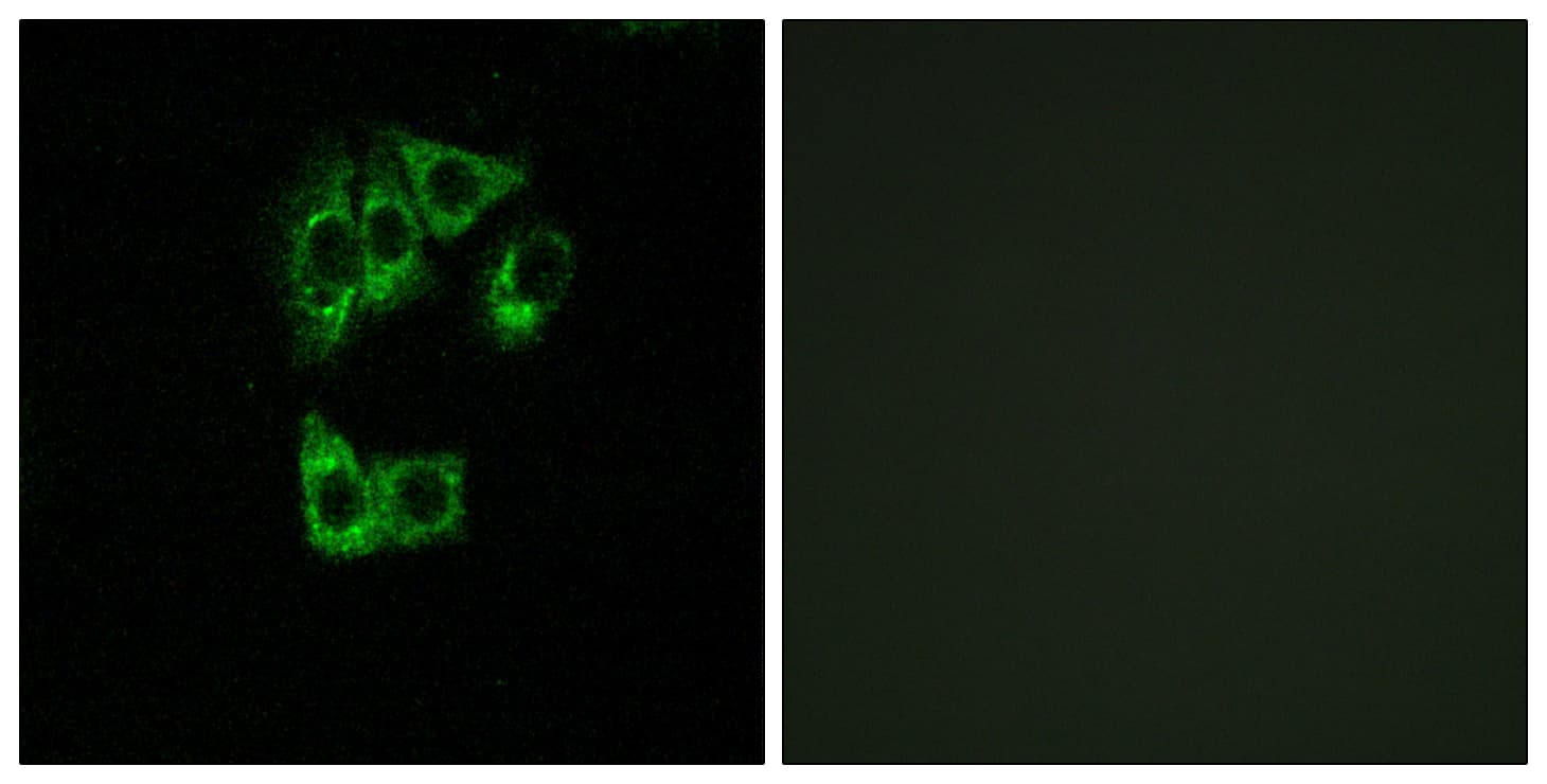 GIMAP2 Antibody (aa201-250)
