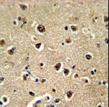 Polyclonal Rabbit anti-Human BAALC Antibody (aa41-68, IHC, WB)