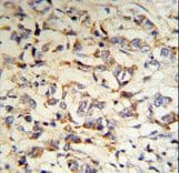 CPN2 Antibody (aa74-103)