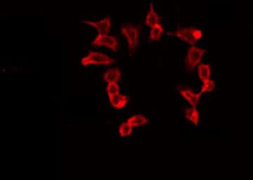 WASF2 / SCAR2 Antibody