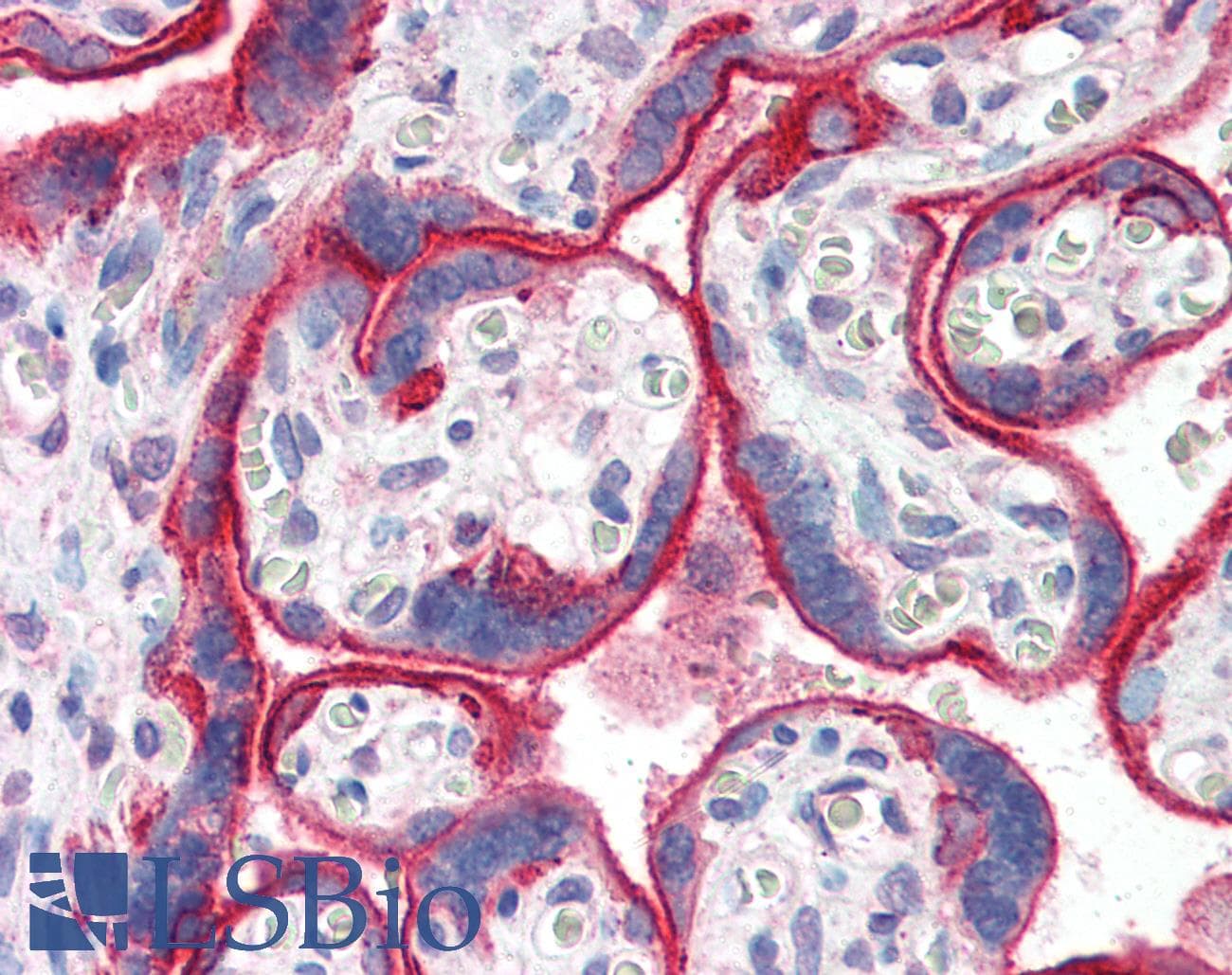 IHC-plus™ Polyclonal Sheep anti-Human EGFR Antibody (Internal, IHC, WB)
