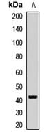 Polyclonal Rabbit anti-Human GTF3A Antibody (WB)