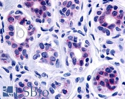 PathPlus™ Polyclonal Rabbit anti-Human ADGRF4 / GPR115 Antibody (C-Terminus, IHC)