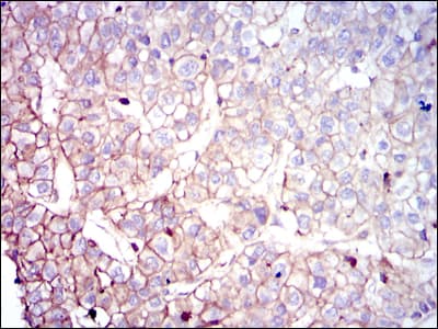 CLP / COTL1 Antibody (clone 5C8)