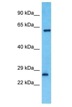 ZNF680 Antibody (aa201-250)