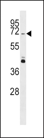 Polyclonal Rabbit anti-Human PINK1 Antibody (aa118-147, IHC, WB)