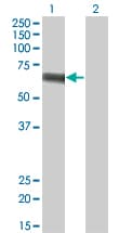IHC-plus™ SLC5A2 / SGLT2 Antibody (clone 3G8)