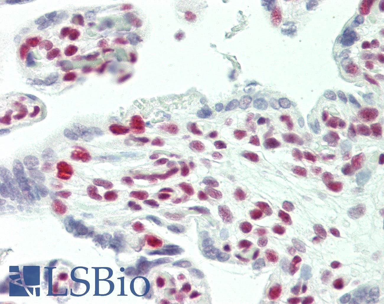IHC-plus™ Polyclonal Rabbit anti-Human TCERG1 / CA150 Antibody (aa1-50, IHC, WB)