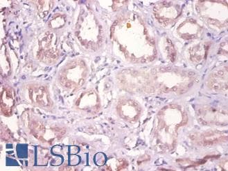 DHRS9 Antibody (HRP)