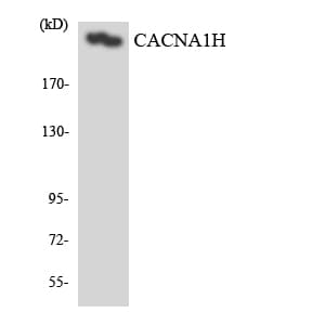 Polyclonal Rabbit anti-Human CACNA1H / Cav3.2 Antibody (aa443-492, WB)