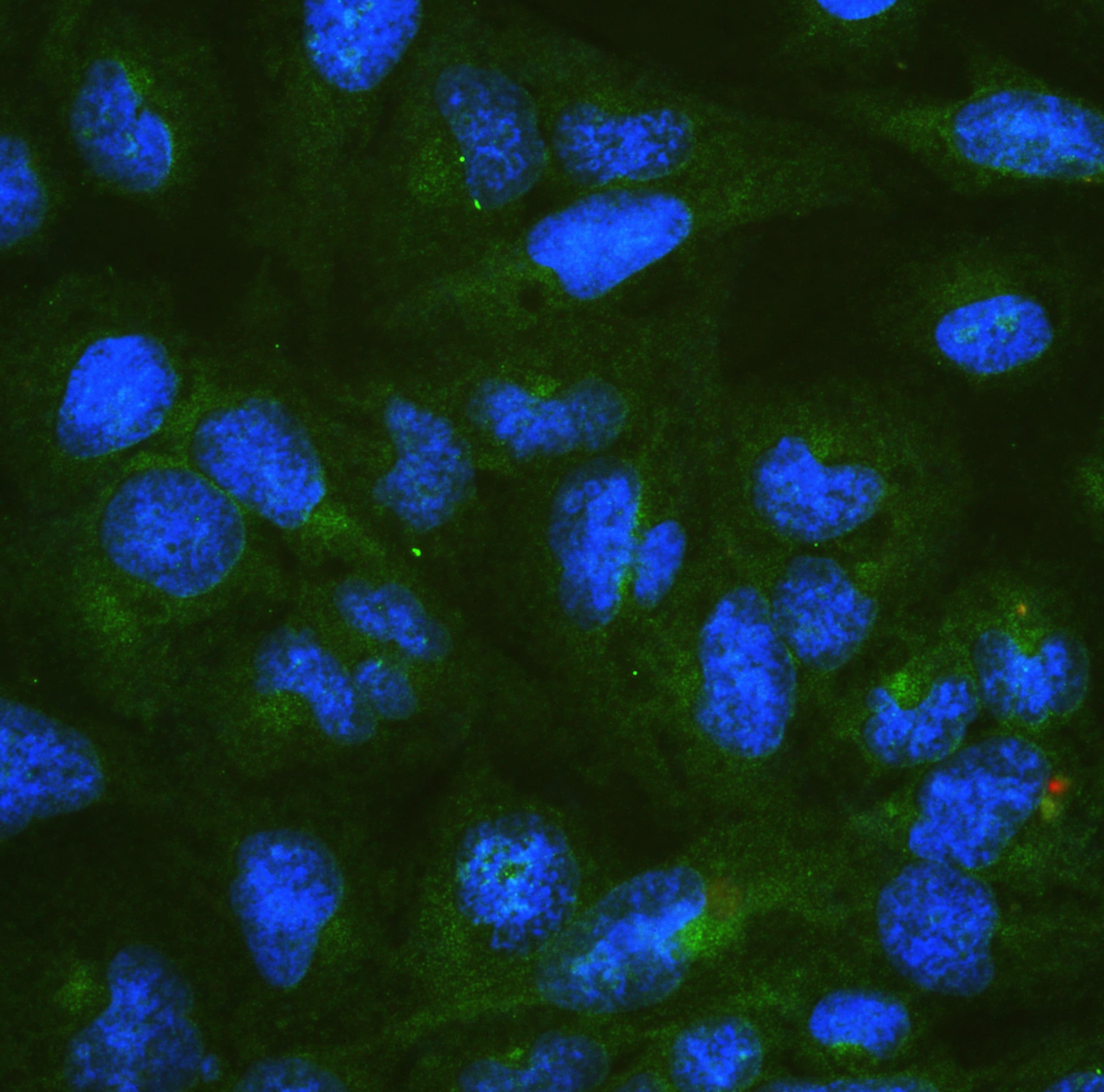 Polyclonal Rabbit anti-Human DYNLT1 / TCTEX-1 Antibody (IHC, WB)