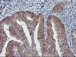 Monoclonal Mouse anti-Human COASY Antibody (clone OTI2H1, IHC, WB)