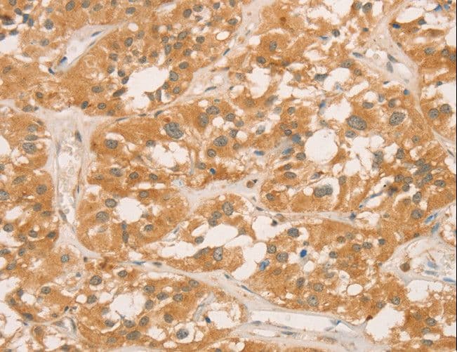 IHC-plus™ Polyclonal Rabbit anti-Human CPB / Carboxypeptidase B Antibody (IHC)
