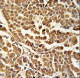 Polyclonal Rabbit anti-Human RNF114 / ZNF313 Antibody (aa167-193, IHC, WB)