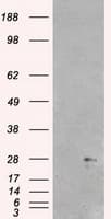NEUROG1 / NGN1 / Neurogenin 1 Antibody (clone OTI5H10)
